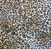 Leopard print swimwear fabric used in Nora Chantre swimwear collection.